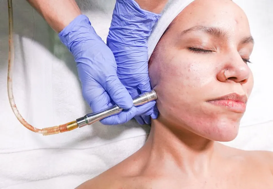 A woman receiving a microdermabrasion facial treatment by a professional with gloved hands.