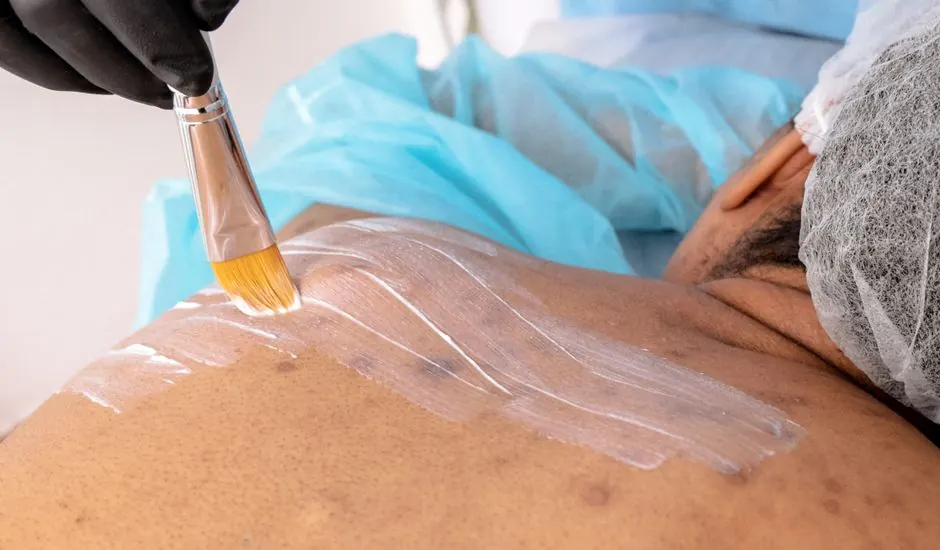 Close-up of a beautician applying treatment to a man's back in a spa.